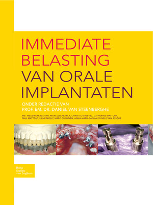 cover image of Immediate belasting van orale implantaten